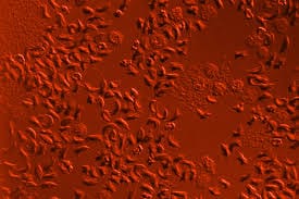Sickle cells microscope-red